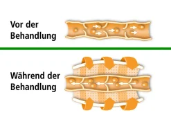 Beurer Venen-Massagegerät FM 150