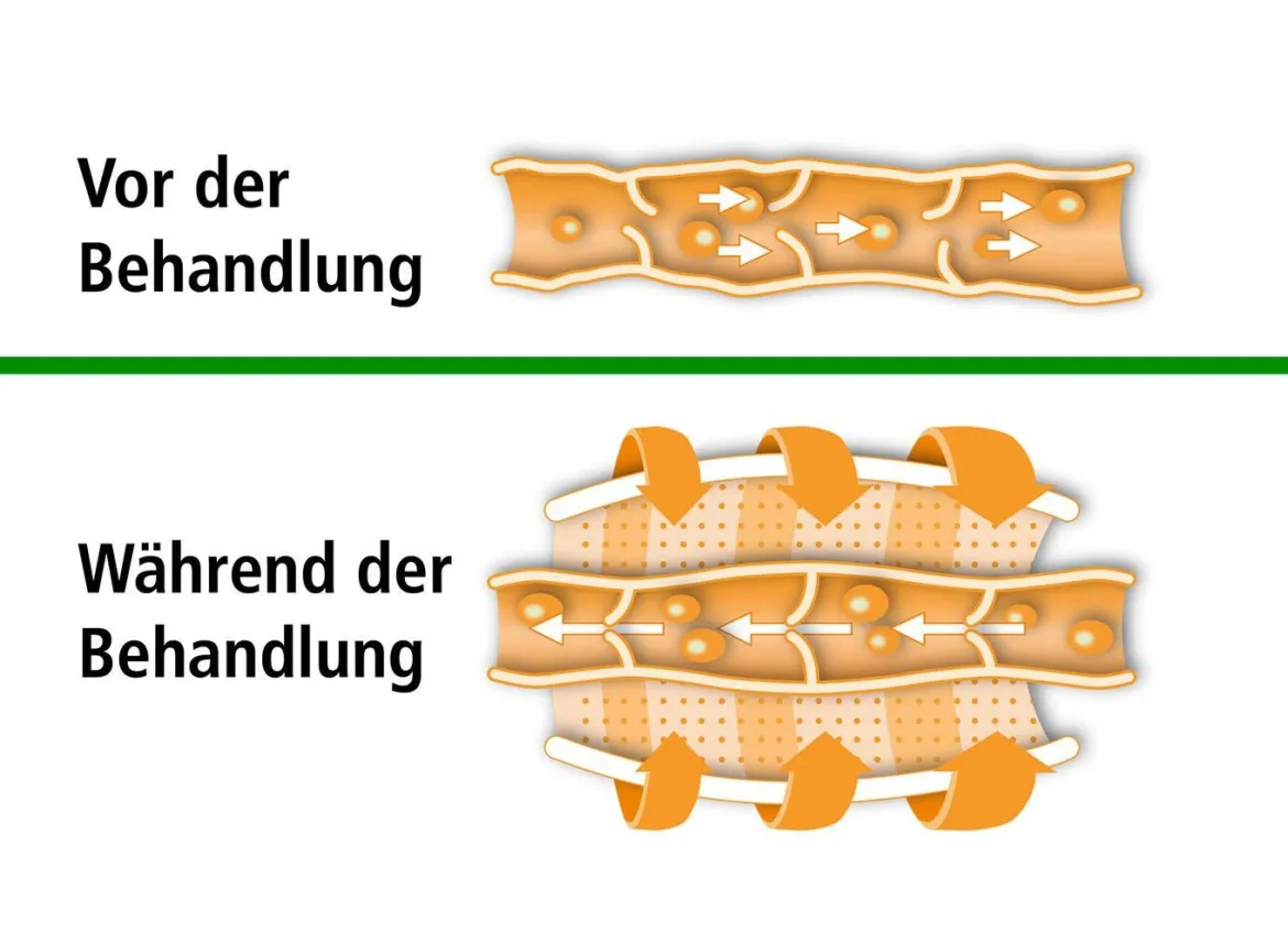 Beurer Venen-Massagegerät FM 150