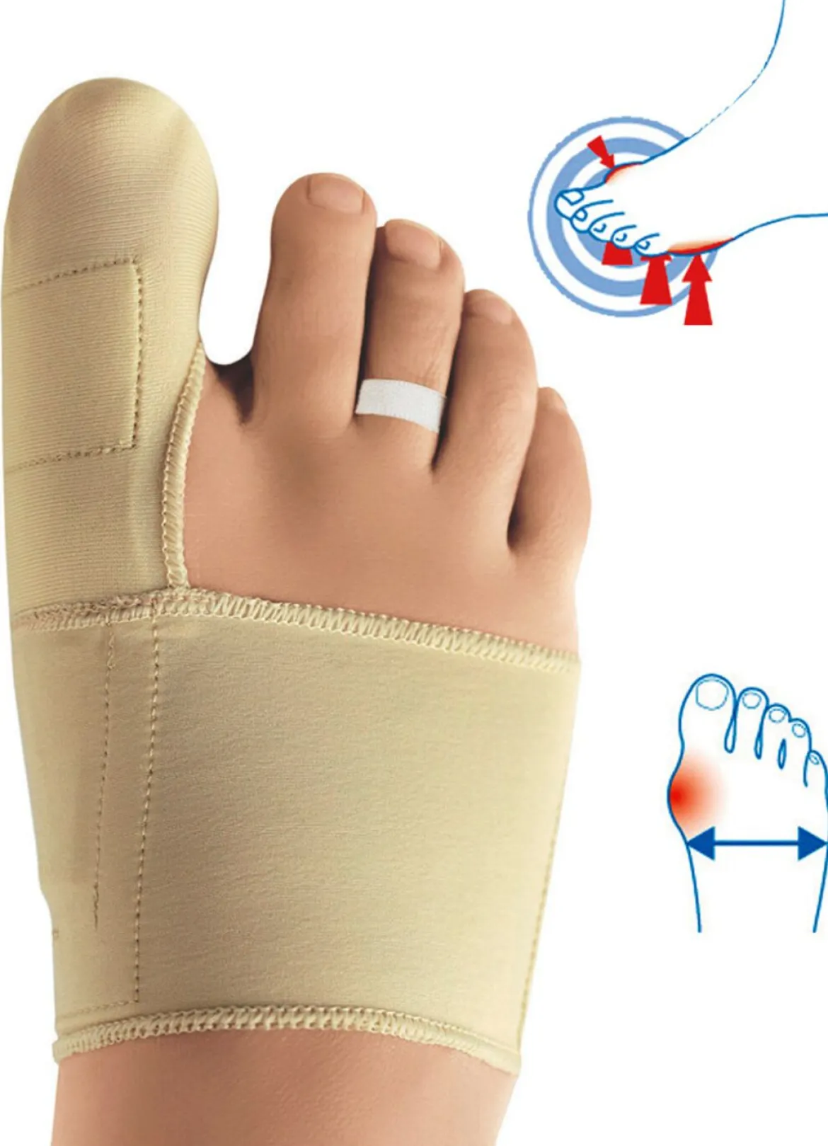 epitact Korrekturorthese Hallux valgus mit Doppelschutz